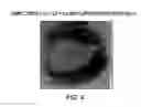 Fig. 05 - Liposomal vaccine