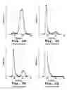 Fig. 03 - Therapeutic liposome composition and method of preparation