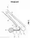 Fig. 03 - Dough moulder