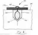 Fig. 09 - Friable sandstone structural blocks