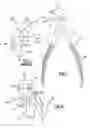 Fig. 02 - Dental pliers design with offsetting jaw and pad elements for assisting in removing upper and lower teeth and method for removing teeth utilizing the dental plier design