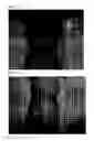 Fig. 07 - Method for preparing platelet-rich plasma