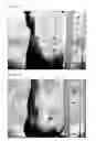 Fig. 08 - Method for preparing platelet-rich plasma
