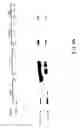 Fig. 06 - Oncoprotein protein kinase