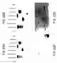 Fig. 43 - Oncoprotein protein kinase