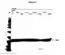 Fig. 07 - Human growth hormone modified at position 35