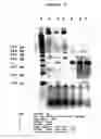 Fig. 06 - Reagents and methods useful for detecting diseases of the lung