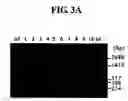 Fig. 04 - Diagnostic method for cancer characterized in the detection of the deletion of G-CSF exon 3