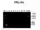 Fig. 08 - Diagnostic method for cancer characterized in the detection of the deletion of G-CSF exon 3