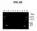 Fig. 09 - Diagnostic method for cancer characterized in the detection of the deletion of G-CSF exon 3