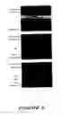 Fig. 06 - Methods of establishing profiles for use in evaluating wound healing and biocompatibility of implant materials and microarrays useful therefor