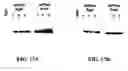 Fig. 45 - Beta-secretase enzyme compositions and methods