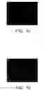 Fig. 02 - Therapeutic reprogramming, hybrid stem cells and maturation