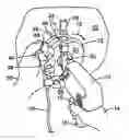 Fig. 01 - Scratch removal tool and system