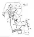 Fig. 04 - Scratch removal tool and system