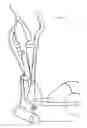 Fig. 03 - Elliptical byke