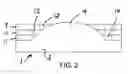 Fig. 03 - Structure and method for increasing proprioceptive demands on foot, ankle and lower leg
