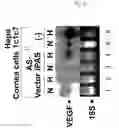 Fig. 15 - Regulation of hypoxia-inducible gene expression with antisense Inhibitory PAS domain protein