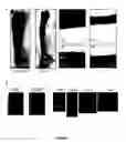 Fig. 02 - Methods and agents for enhancing bone formation or preventing bone loss