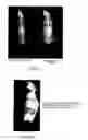 Fig. 03 - Methods and agents for enhancing bone formation or preventing bone loss