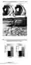 Fig. 17 - Methods and agents for enhancing bone formation or preventing bone loss