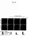 Fig. 09 - Therapeutic composition of treating abnormal splicing caused by the excessive kinase induction