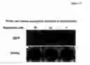 Fig. 14 - Compositions for treating or preventing obesity and insulin resistance disorders