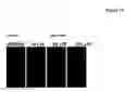 Fig. 17 - Compositions for treating or preventing obesity and insulin resistance disorders