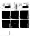 Fig. 09 - Methods of treating disorders with Group I mGluR antagonists