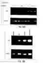 Fig. 14 - Methods and reagents for the treatment of multiple sclerosis