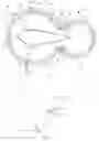 Fig. 02 - Surgical retractor having suture control features