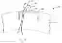 Fig. 04 - Surgical retractor having suture control features