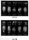 Fig. 09 - Methods for imaging the lymphatic system using dendrimer-based contrast agents