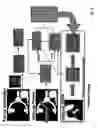 Fig. 04 - Registration of ultrasound to fluoroscopy for real time optimization of radiation implant procedures