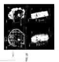 Fig. 22 - Processing and displaying breast ultrasound information