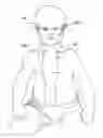 Fig. 01 - Cerebral spinal fluid shunt evaluation system