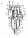Fig. 01 - Pneumoperitoneum needle