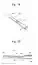 Fig. 04 - Rapid exchange stent delivery system and associated components
