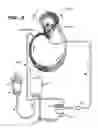 Fig. 04 - Multichannel catheter