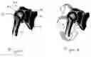 Fig. 02 - Apparatus & method for joint surgery