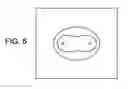 Fig. 07 - Irreversible electroporation to control bleeding