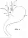 Fig. 02 - Devices and methods for treatment of luminal tissue