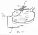 Fig. 07 - Circumferential ablation device assembly with an expandable member