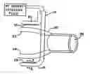 Fig. 01 - Transmural ablation device
