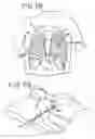 Fig. 41 - Transmural ablation device