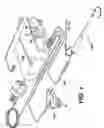 Fig. 02 - Bipolar electrosurgical snare