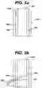 Fig. 08 - Bipolar electrosurgical snare