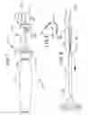 Fig. 06 - Apparatus for mapping and coagulating soft tissue in or around body orifices