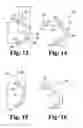 Fig. 07 - Orthopedic distraction implants and techniques