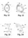 Fig. 09 - Orthopedic distraction implants and techniques